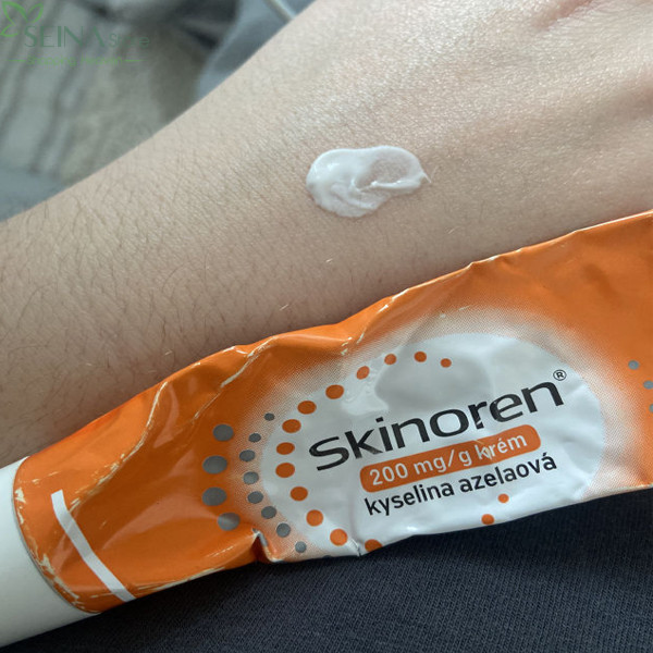 Kem tri mun Skinoren Acidum Azelaicum 30g - 2